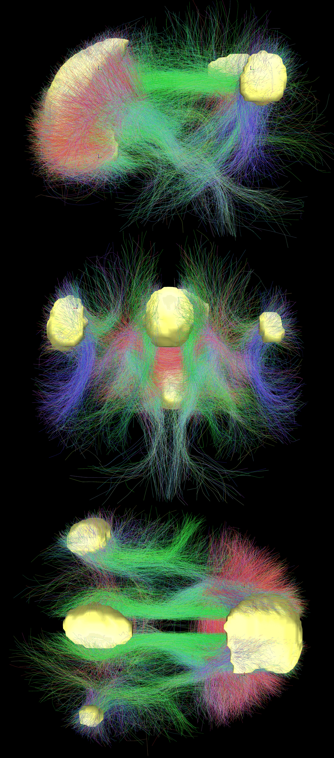 Schema della connettività funzionale del Default Mode Network nel cervello umano