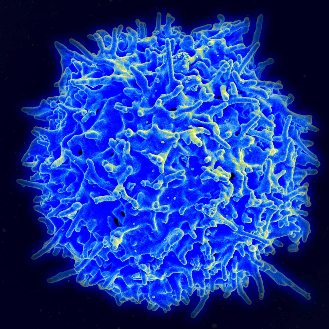 Immagine al microscopio elettronico a scansione di un linfocita T umano sano
