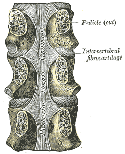 Sezione anatomica della colonna vertebrale con due vertebre e il disco intervertebrale composto da anello fibroso e nucleo polposo