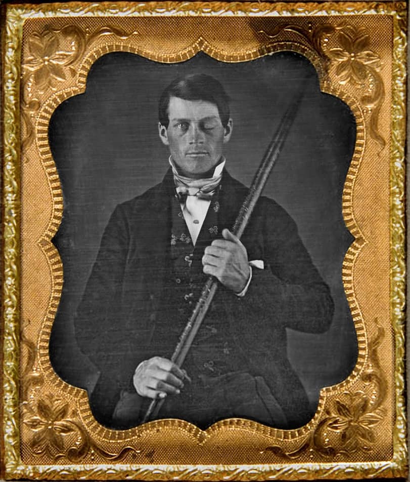Dagherrotipo di Phineas Gage che tiene in mano la barra di ferro che lo ferì
