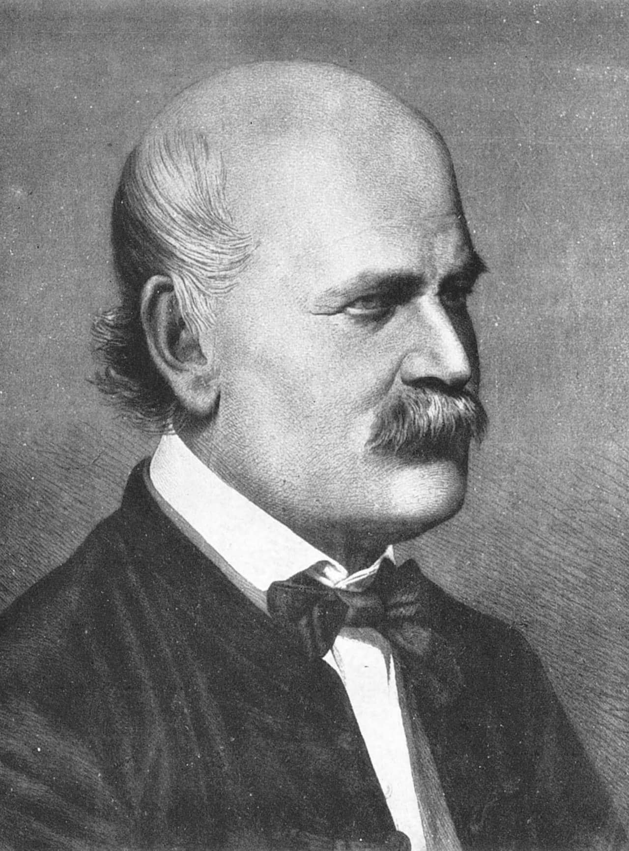 Ritratto del medico ungherese Ignác Semmelweis